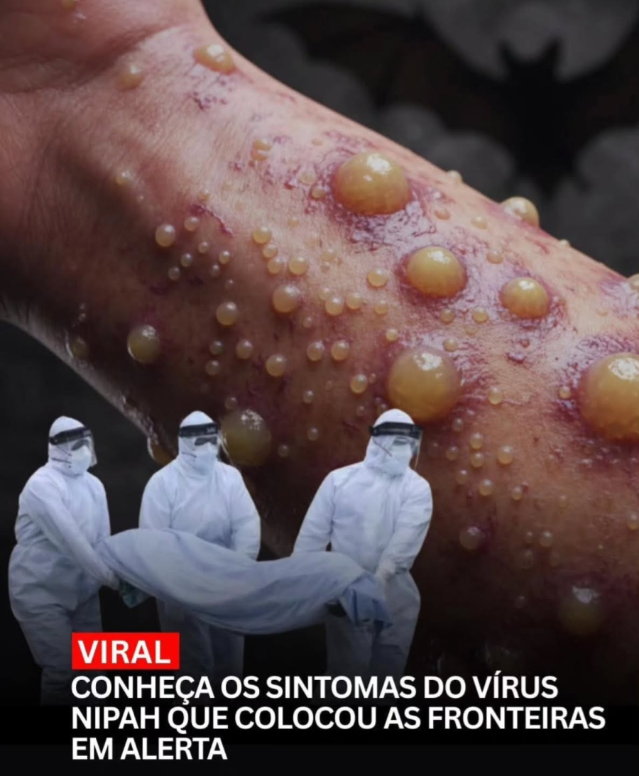 URGENTE - SURTO DE VÍRUS NIPAH NA ÍNDIA